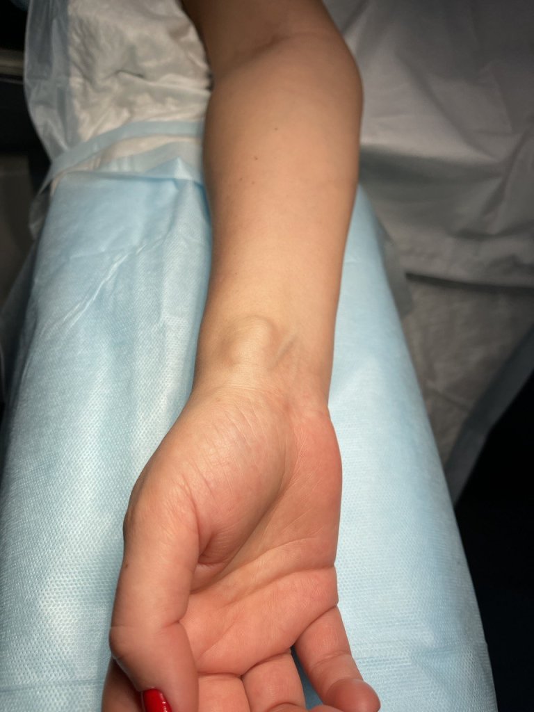 Удаление гигромы_1.jpg