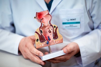 Лечение геморроя: причины, симптомы, современные методы и профилактика